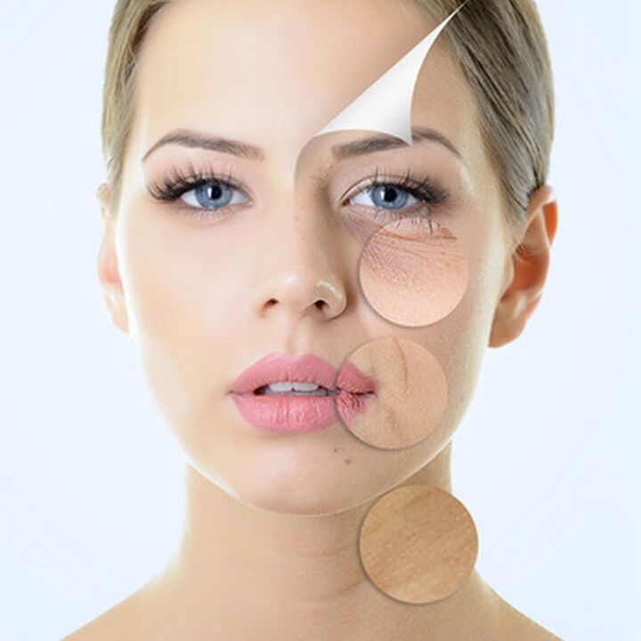 Imperfeições da pele facial - indicações para procedimentos antienvelhecimento