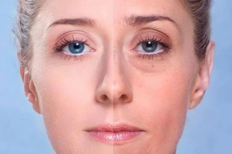 Costas sob os olhos